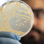 Some ancient microbes frozen with Ötzi the Iceman are still growing