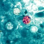 Trump admin shelves Cyclospora research despite record-breaking outbreak